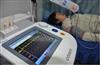 日本欧姆龙进口动脉硬化检测仪